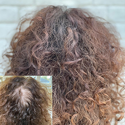 Een volumebehandeling