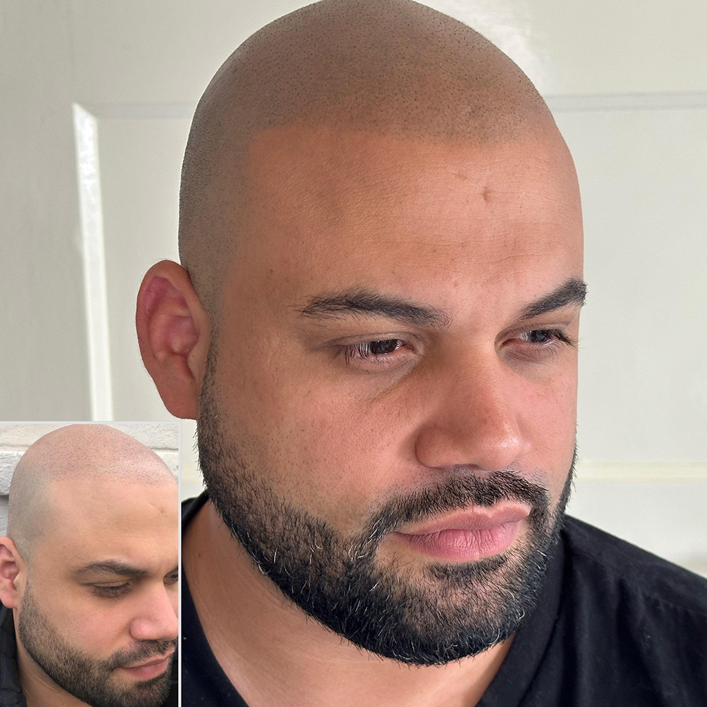 behandelingen geschoren look