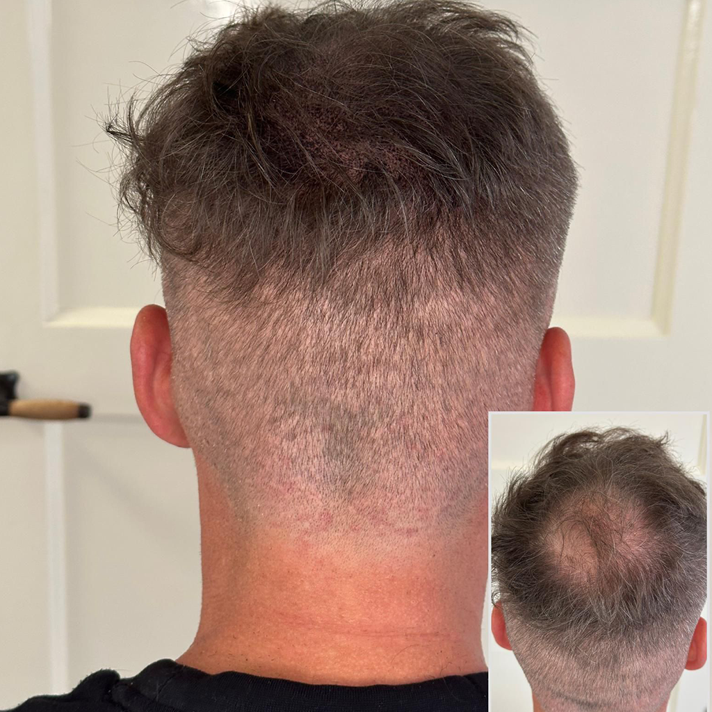 behandelingen volume man